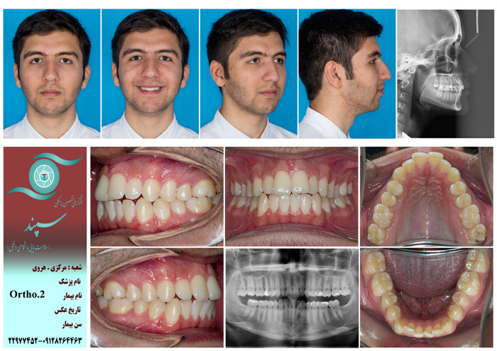 فتوگرافی دندان پزشکی و فتوگرافی ارتودنسی چیست ؟